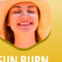 Sun Burn